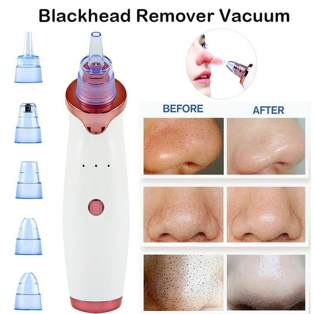 Electric Skin Careful Face Pore Cleaning Blackhead Acne Vacuum Cleaner Remove EK 
